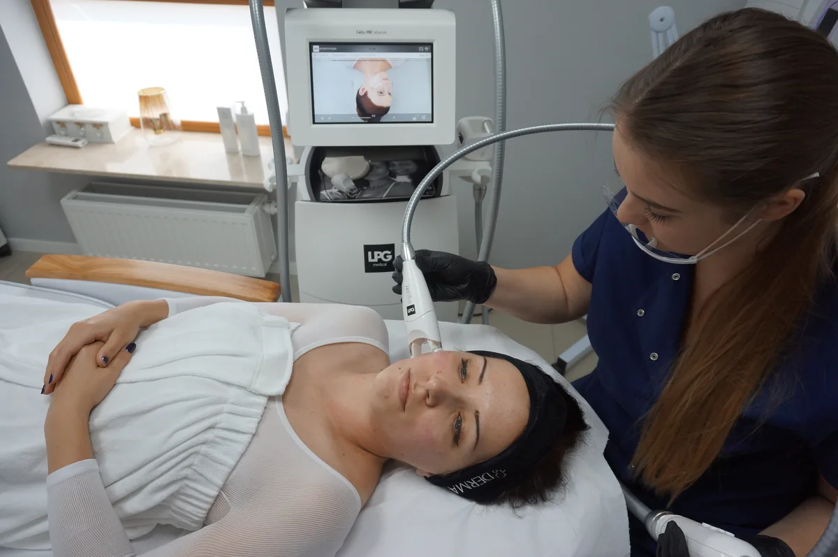Zabieg endermologii twarzy LPG